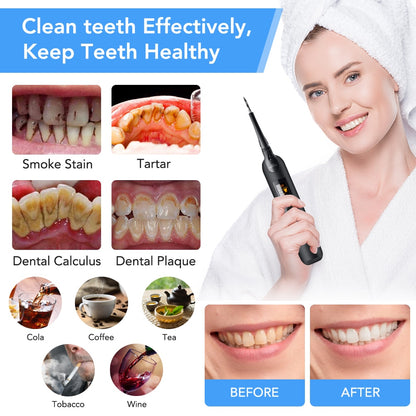 Electric Sonic Dental Calculus Remover Whitener Scaler LED Display Tooth Cleaner Rechargable Tartar Tool Whiteing Teeth Portable